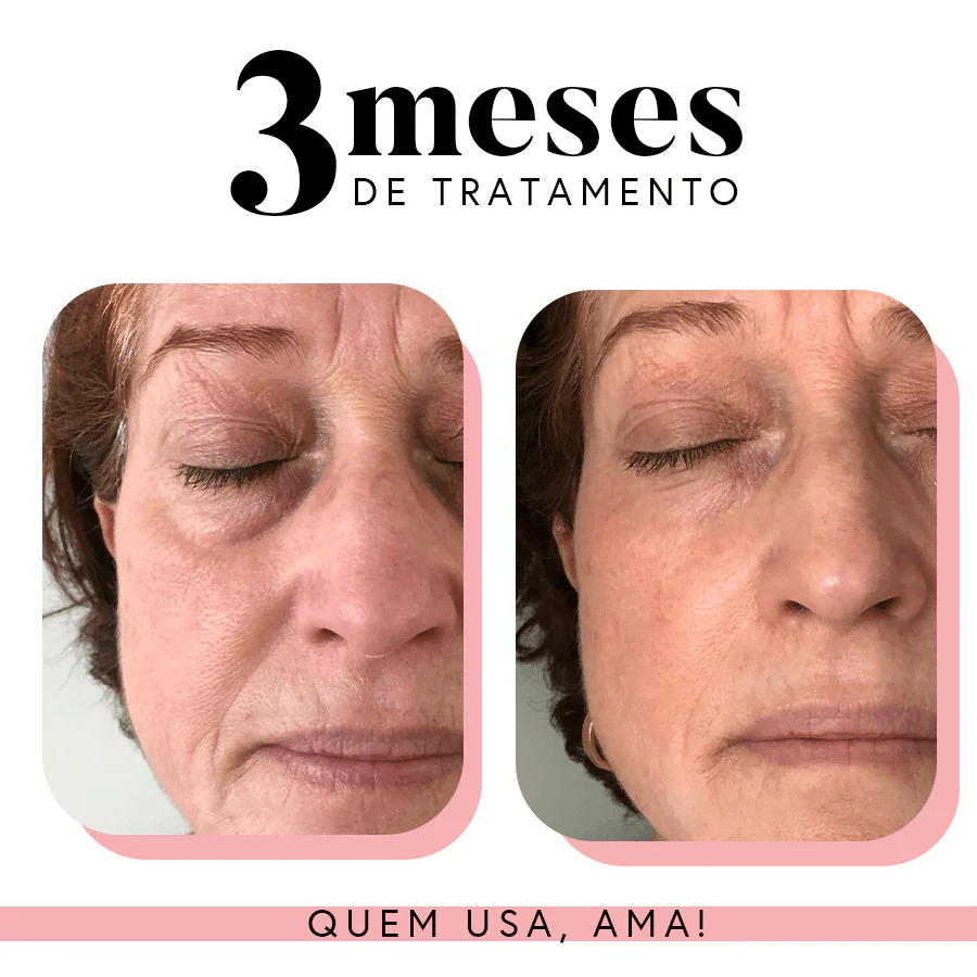 Imagem do produto 15