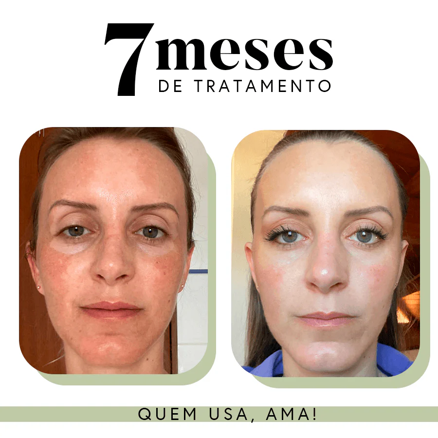 Imagem do produto 16